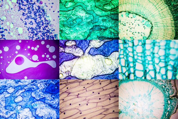 We provide consulting for optimal experiment setup and advanced light microscopy image analysis for scientific research.